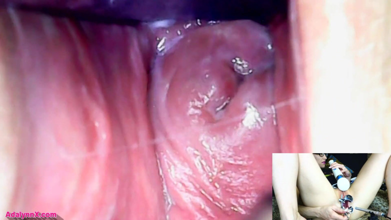 AdalynnX: Adalynnx - endoskop speculum hitachi vib