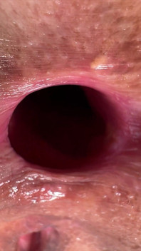 A girl with a WIDE BUTTHOLE fucks Insta reel of girl with a BIG MOUTH.mp4