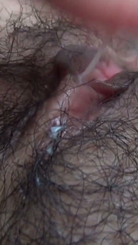 The Mound of the Clitoris