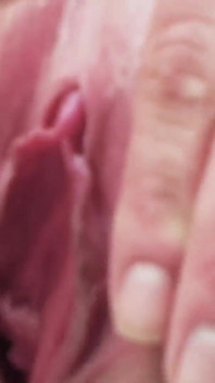 Marie must go to the gynecologist