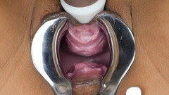 SexyThai1987: Speculum - have a look deep inside me