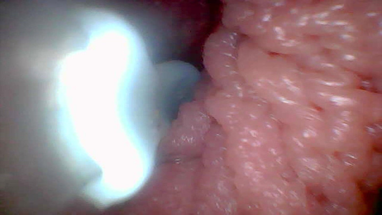 Twittiy: Pojďme Se Společně Podívat Do Mé Šťavnaté Kundičky (endoskopická Kamera)