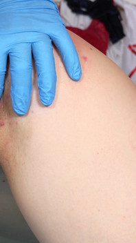 Teen nerd girl fingered to orgasm by two old doctors