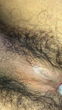 I Need You to Put Your Penis in I Can't Stand This Fever Anymore