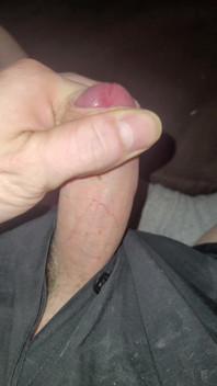 Penis