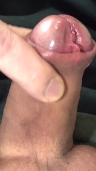 My Foreskin Penis and Loose Asshole 2026 #05