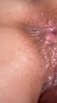 Stepdad Checking Out the Condition of My Asshole and Vagina Because He Is a Gynecologist