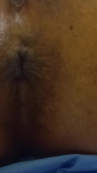 Showing Pussy and Asshole