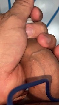 Sounding Extreme Sharp Probing in the Urethral Canal.
