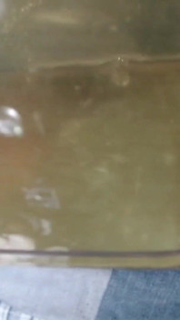Semen and Urine in a Container