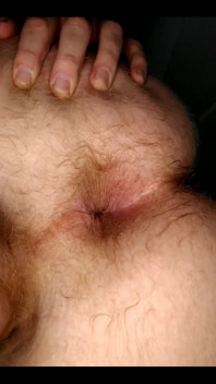 My Anal