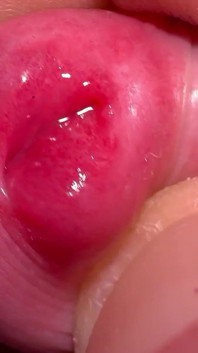 Macro piel en mi polla