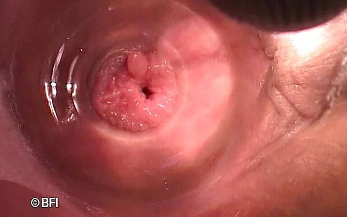 Pegging insertion: Bizarní soubory 162