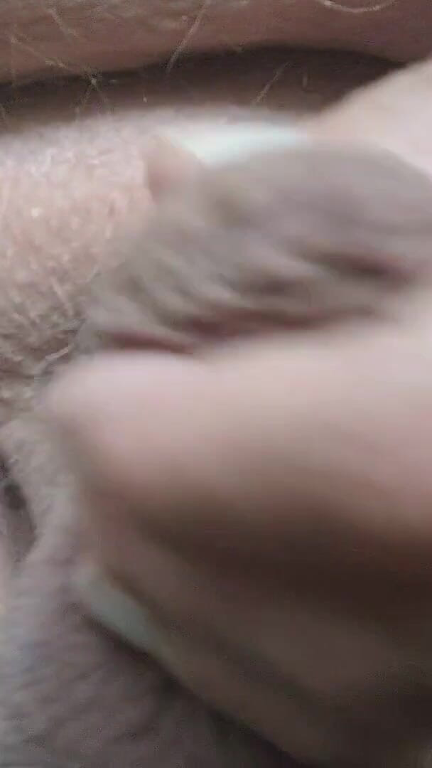 My Penis Close up (Karlchengeil)
