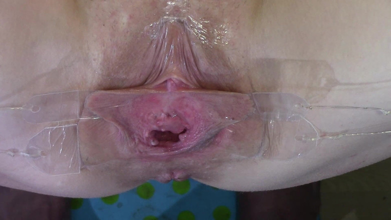 deep keely: 6 Cazzo Di Cazzo Aperto Molto Vicino