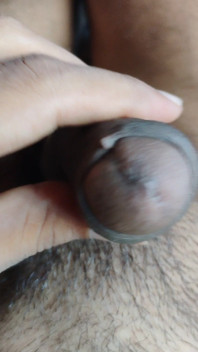 My Penis