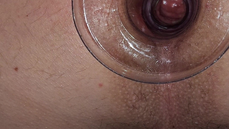 NiceBum2: Profundo en mi culo en primer plano