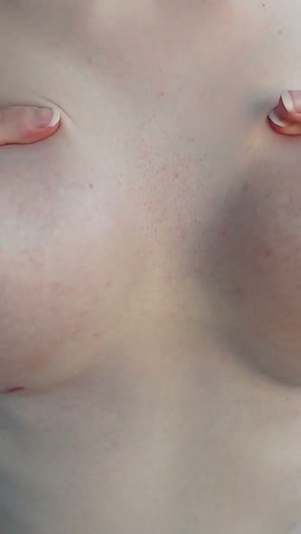 HotRedWildcat: Massaging and Squeezing My Boobs After Reconstruction