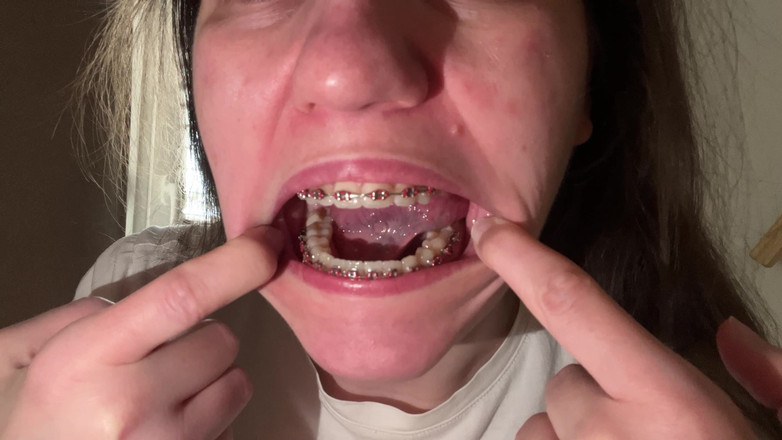 NicoleRay: Olizování rovnátek jazykem