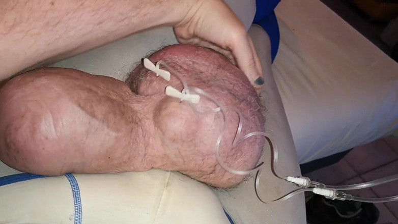 Monster_Meat_: Double fillings of 2liters glucose