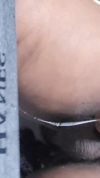 Prostate milking