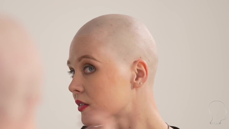Euro Bald: Layla