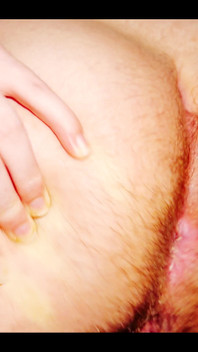 Being Pregnant Makes It Hard to Hold in Farts