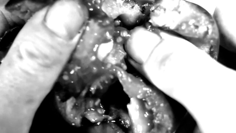 Kane Santiago: Fetiche de manos - mis manos destruyendo flores y frutas