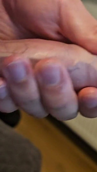 Neobřezaný zakřivený penis