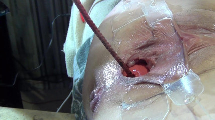 deep keely: Kulečník 4