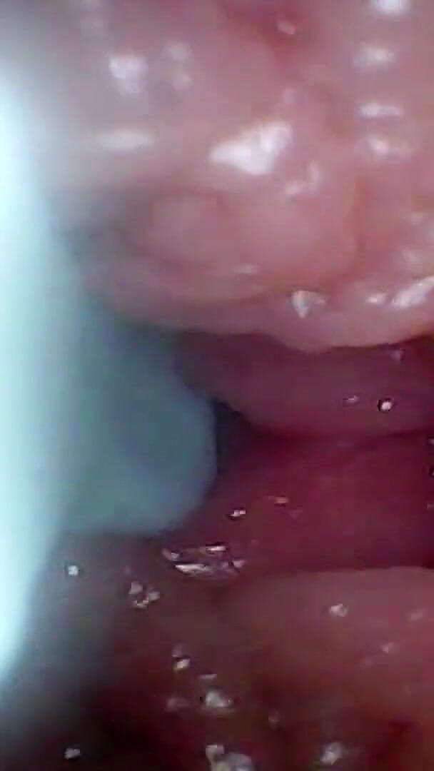 Ladybottox: Endoskopová Kamera Nahrává G Bod Mé Ženy. Vzdělávací Video Zblízka