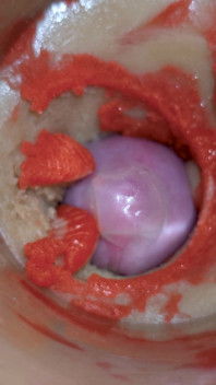 The Camera Inside the Deep Pussy Records a Huge Ejaculation with a Stuck Condom 4K