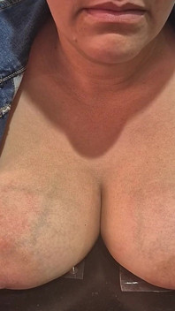 It's Time to Tort My Breasts, but It's a Surprise What They'll Do to Me