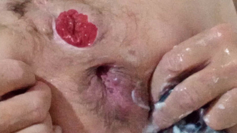 Lizzy Yum: Lizzy yum sd tháng 12 năm 2025 Post Op Shemale thủ dâm # 56