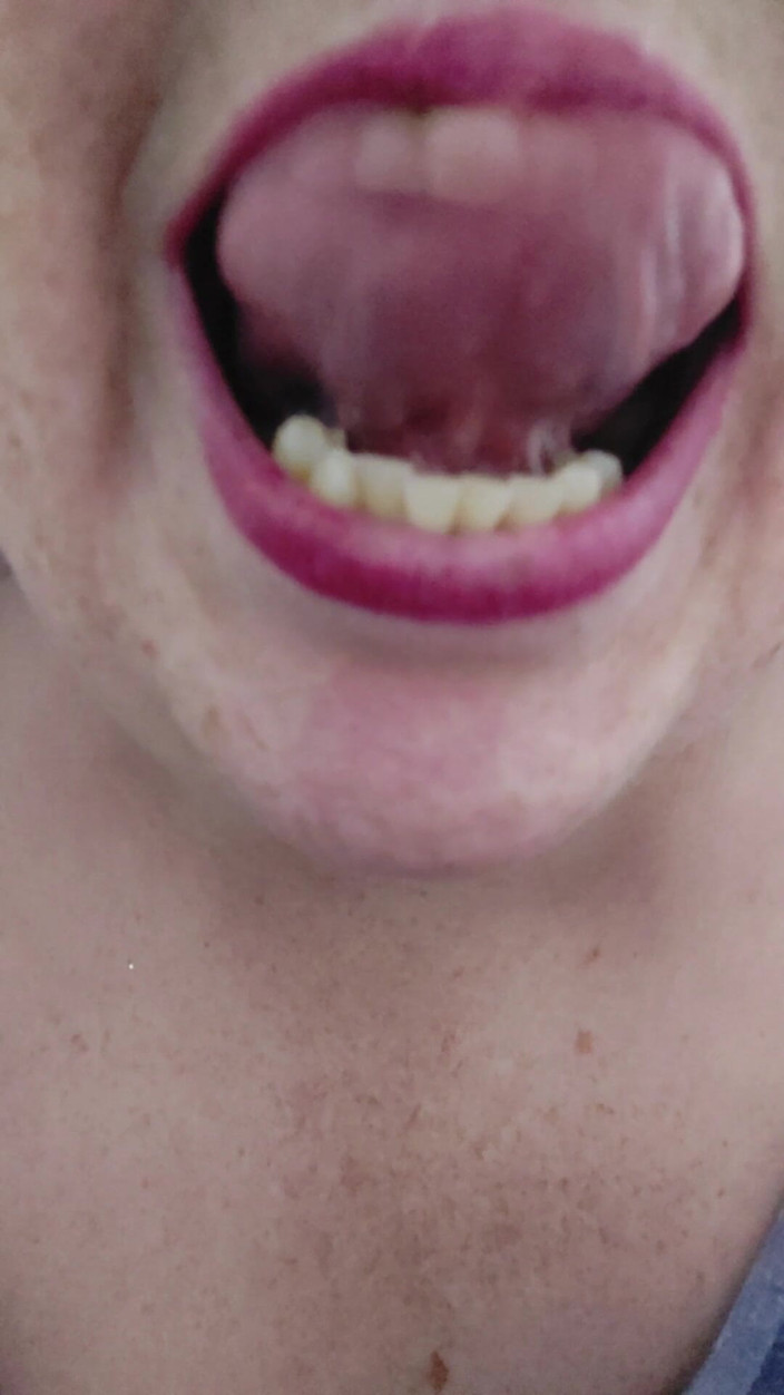 AngYourDirtyCanadian: Some Mouth Togue and Teeth