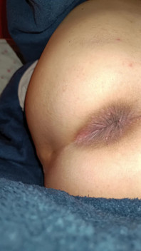 My Anus