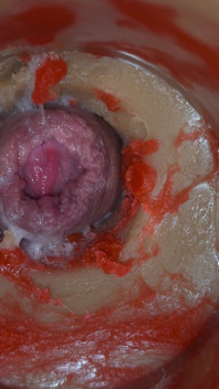 Insemination - Internal Camera Captures Deep Male Ejaculation