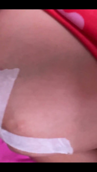 My Boob Is About to Explode