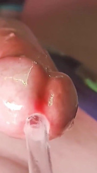 Oh My God! I Penetrate My Penis Eye!