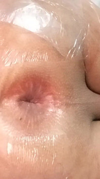 내 엉덩이를 열어줘