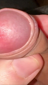 Juicy Small Cock Foreskin Games