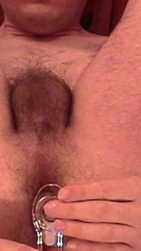 Anální spekulum – masturbace rukou