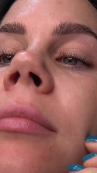 Anna Sneezes dan menghisap hidungnya dengan hidung babi