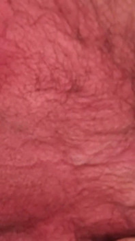 I Spread My Anal Opening.