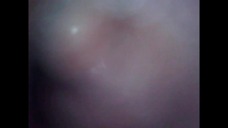 LizAngel: 내 질에 다시 내시경