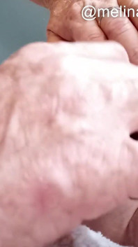 Anal Polishing