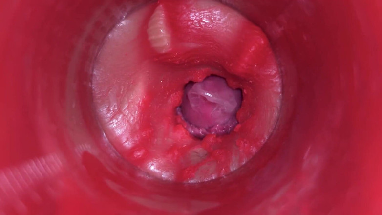 Ladybottox: Cameră în interiorul pizdei: puternic spermă în pizdă! Cel mai bun asmr...