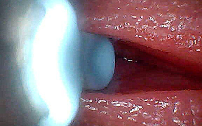 Creme sperm: 我不敢相信当精子通过时内部会发生什么（内镜录像）