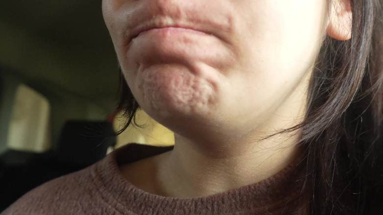 AmayaMori: 내 플라스틱 꽃 알레르기 반응 차에 재채기 적합