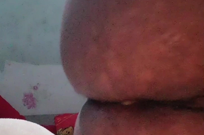 Renata Himalaya: 用茄子自慰撕裂我的菊花